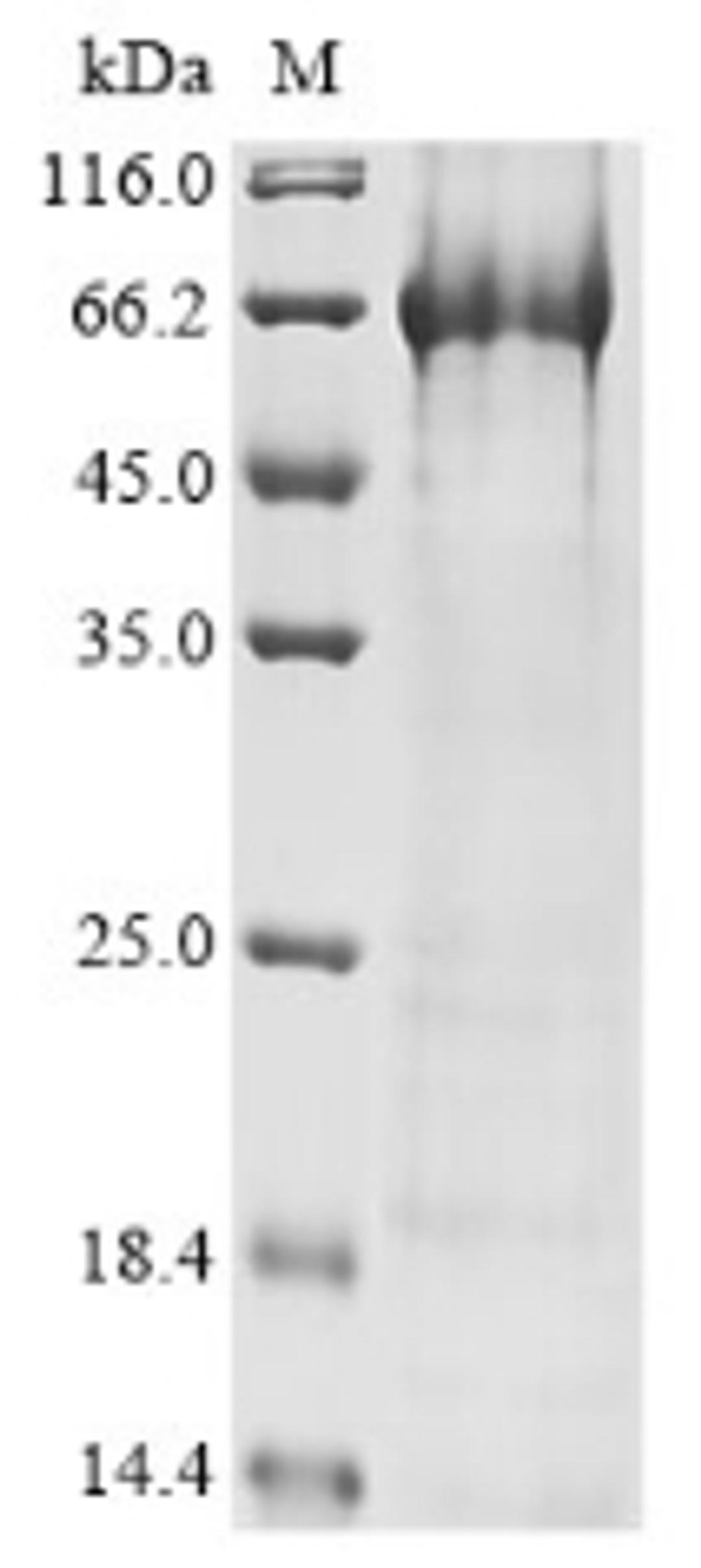 (Tris-Glycine gel) Discontinuous SDS-PAGE (reduced) with 5% enrichment gel and 15% separation gel.