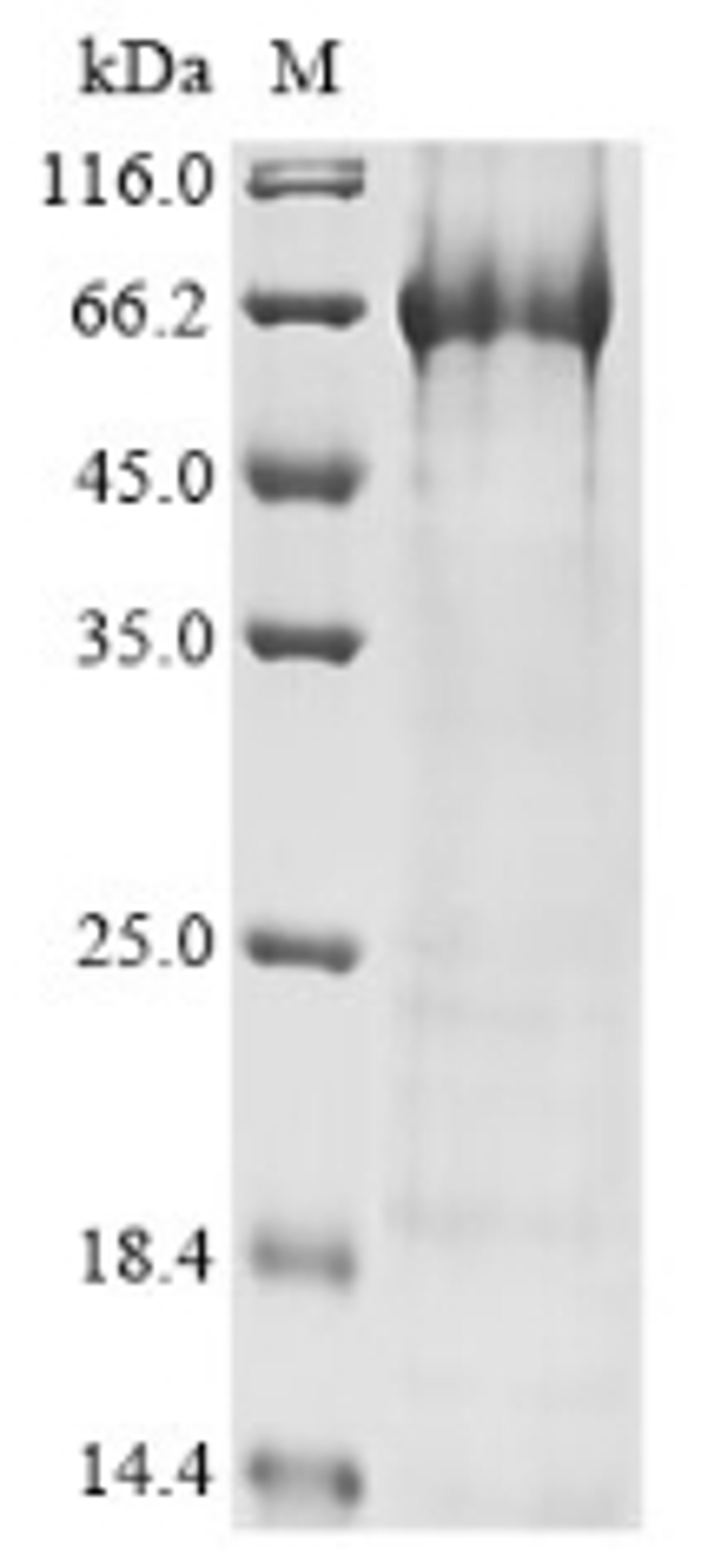 (Tris-Glycine gel) Discontinuous SDS-PAGE (reduced) with 5% enrichment gel and 15% separation gel.