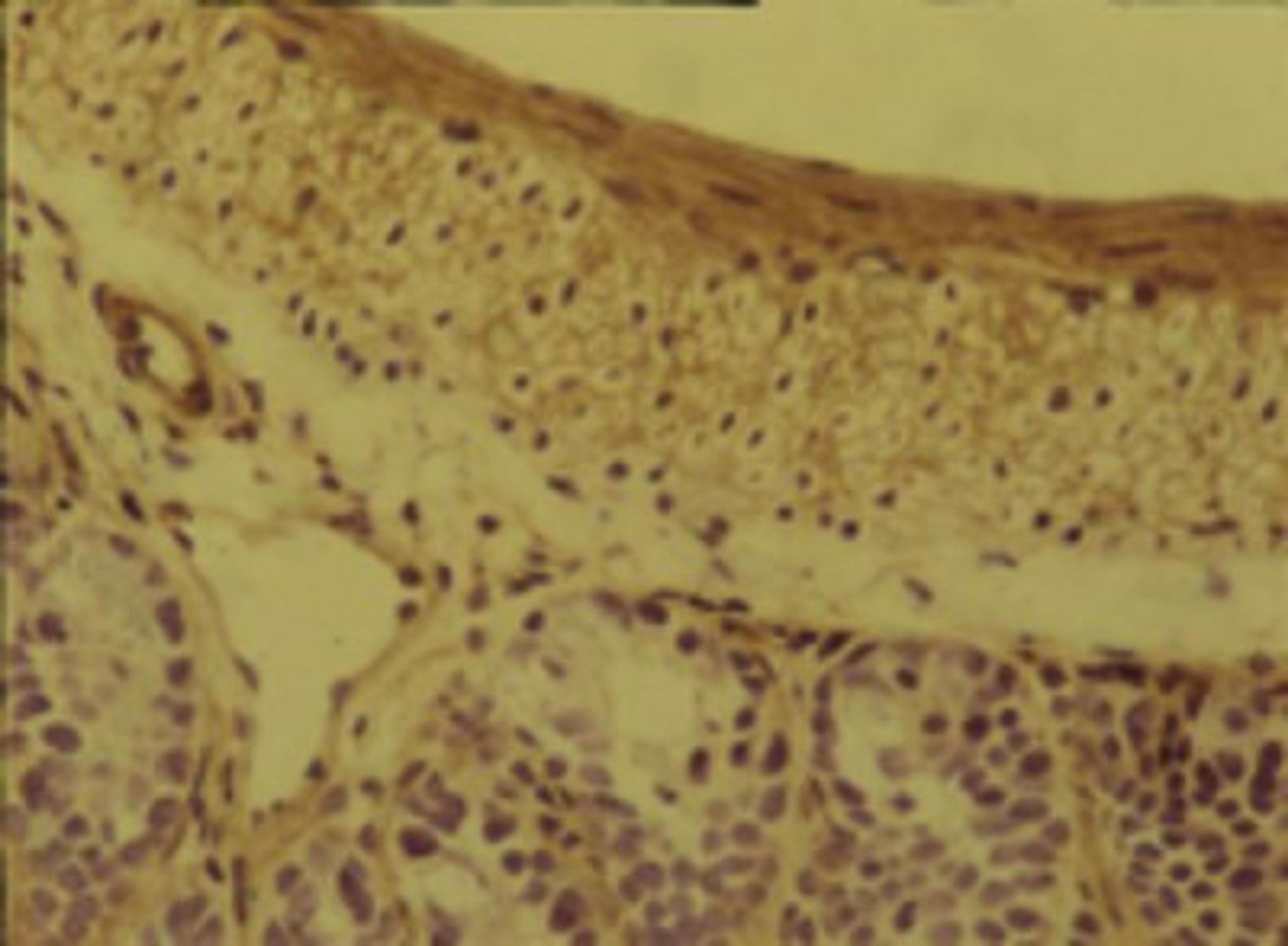 Immunohistochemistry: Integrin alpha 5 Antibody (BMC5) [NBP2-29788] - Rat anti-Mouse Integrin alpha5beta1  staining of mouse gut.