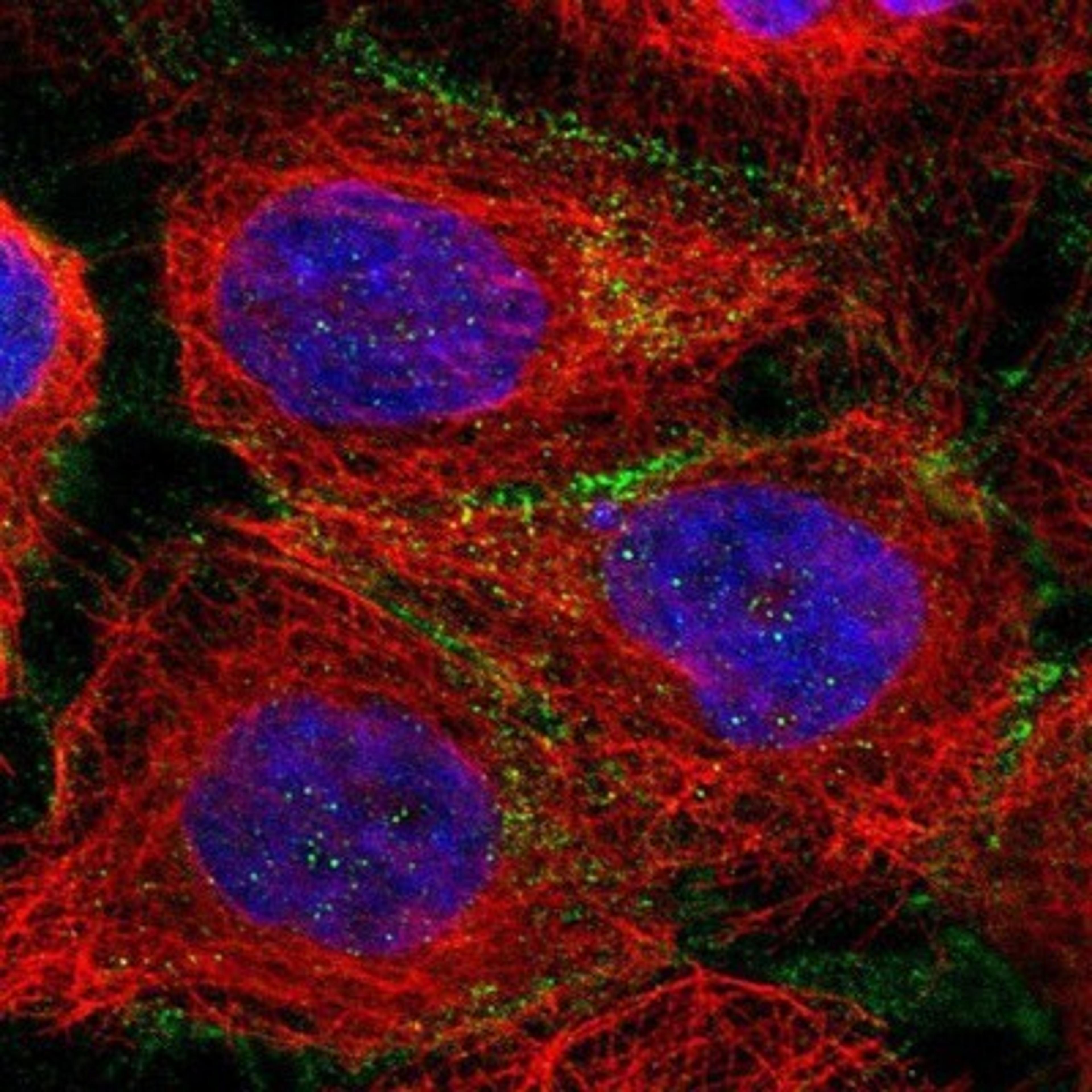 Immunocytochemistry/Immunofluorescence: p120-catenin Antibody [NBP1-85383] - Staining of human cell line A-431 shows positivity in plasma membrane.