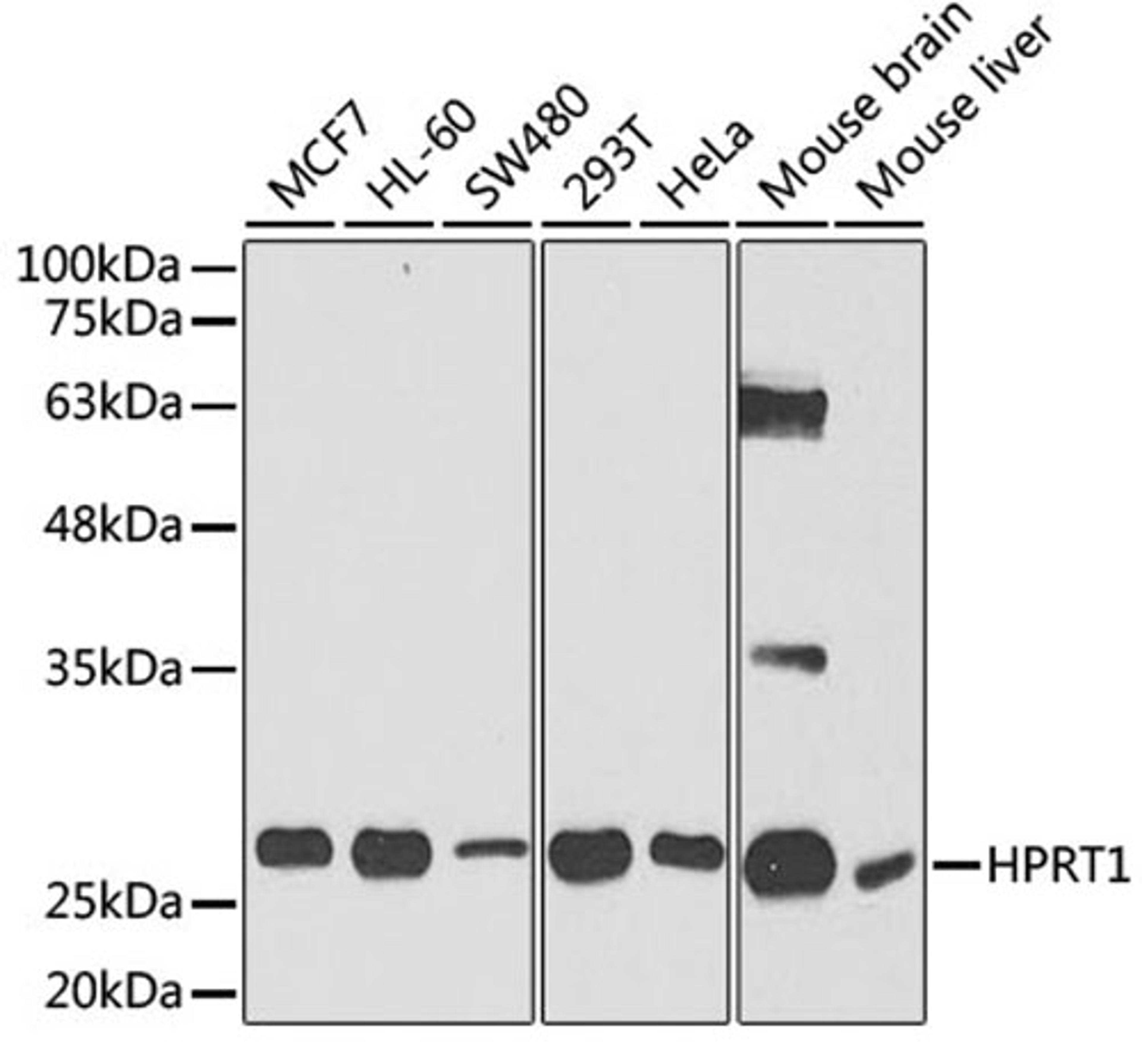 Western blot - HPRT1 antibody (A5692)