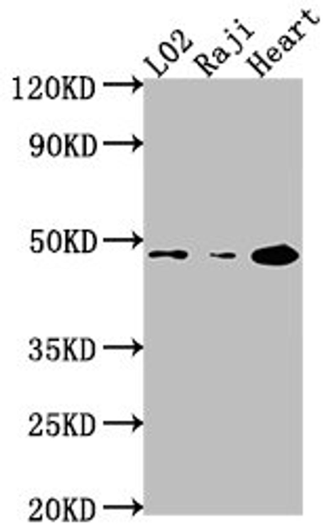 Western Blot. Positive WB detected in: L02 whole cell lysate, Raji whole cell lysate, Mouse heart tissue. All lanes: CASP9 antibody at 1:2000. Secondary. Goat polyclonal to rabbit IgG at 1/50000 dilution. Predicted band size: 47, 31, 18, 37 kDa. Observed band size: 47 kDa. 