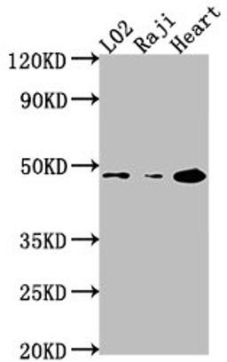 Western Blot. Positive WB detected in: L02 whole cell lysate, Raji whole cell lysate, Mouse heart tissue. All lanes: CASP9 antibody at 1:2000. Secondary. Goat polyclonal to rabbit IgG at 1/50000 dilution. Predicted band size: 47, 31, 18, 37 kDa. Observed band size: 47 kDa. 