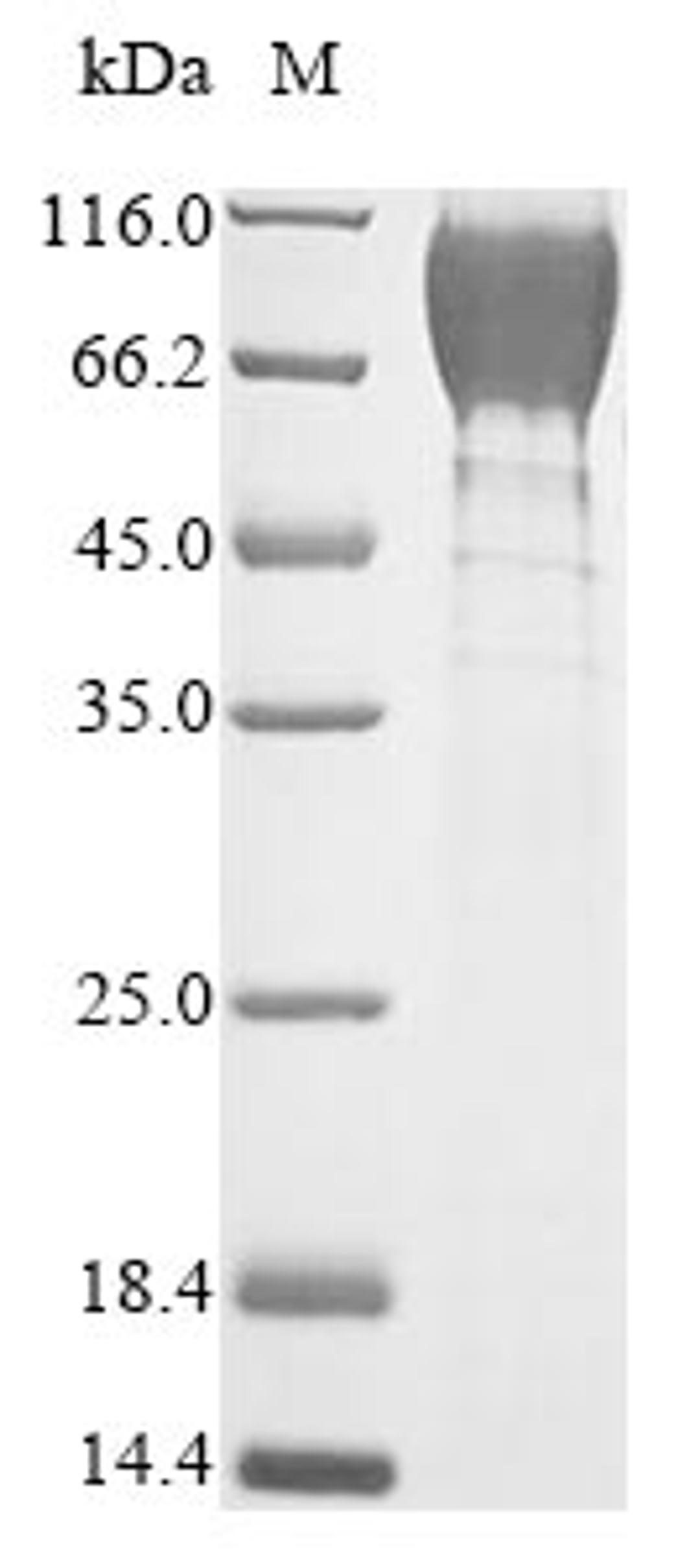 (Tris-Glycine gel) Discontinuous SDS-PAGE (reduced) with 5% enrichment gel and 15% separation gel.