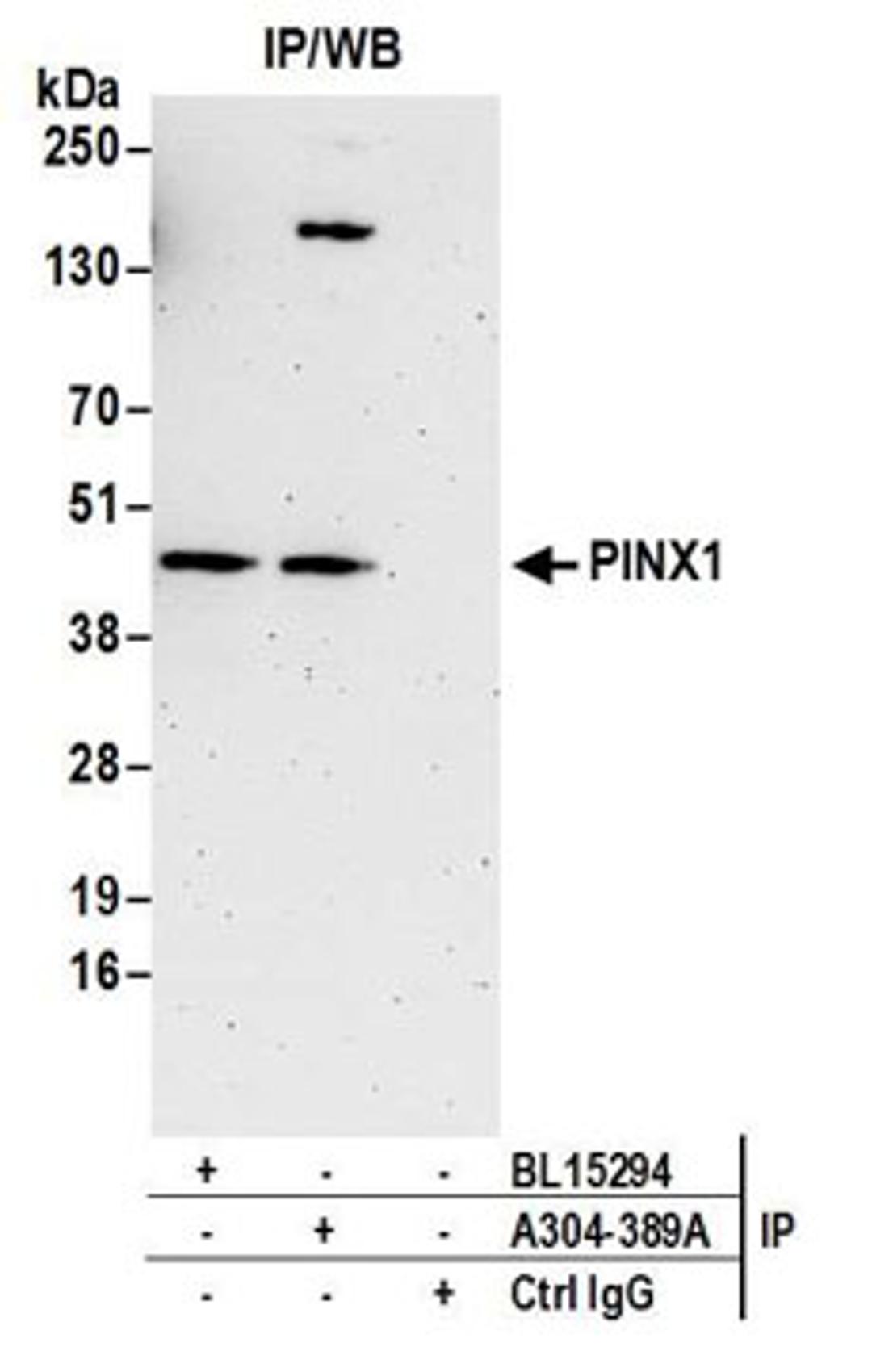 Detection of human PINX1 by western blot of immunoprecipitates.