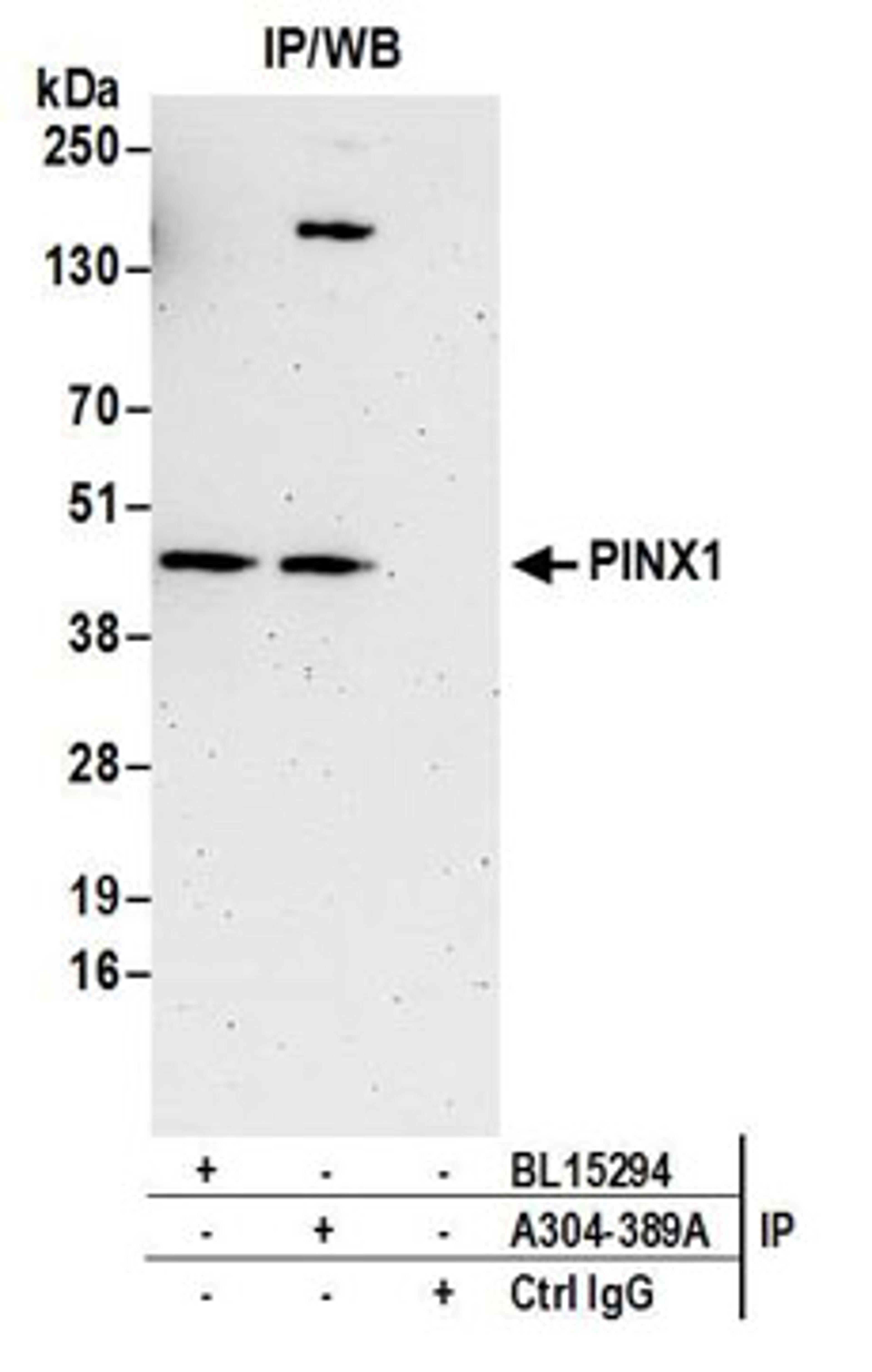 Detection of human PINX1 by western blot of immunoprecipitates.