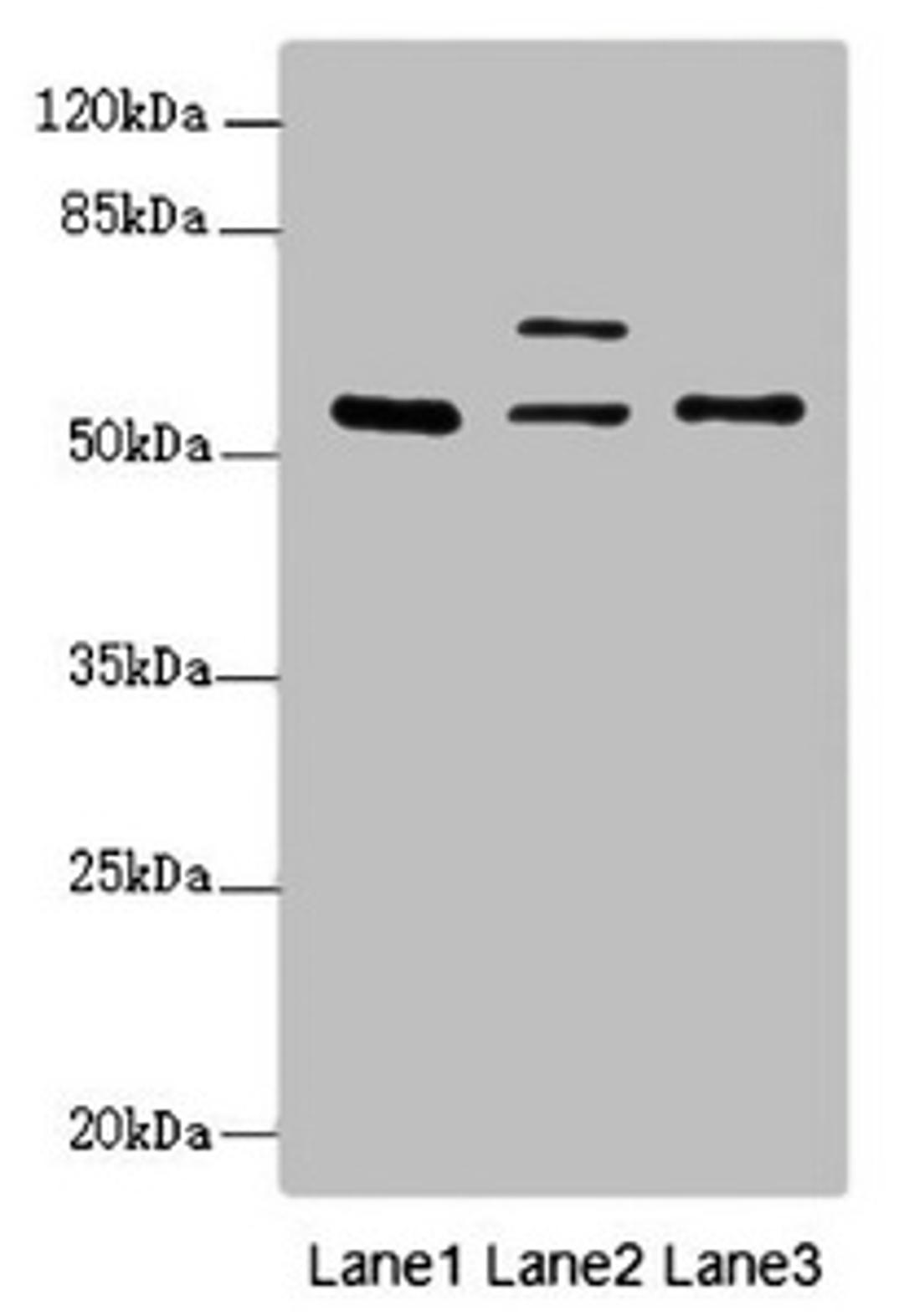Western blot. All lanes: ERO1L antibody at 2.01ug/ml. Lane 1: HepG2 whole cell lysate. Lane 2: Hela whole cell lysate. Lane 3: MCF-7 whole cell lysate. Secondary. Goat polyclonal to rabbit IgG at 1/10000 dilution. Predicted band size: 54 kDa. Observed band size: 54, 62 kDa.