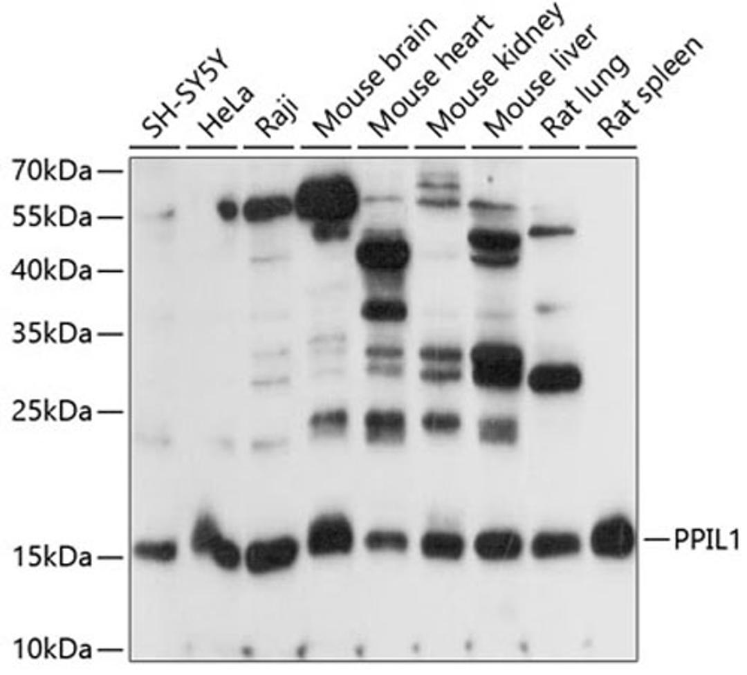 Western blot - PPIL1 antibody (A14892)