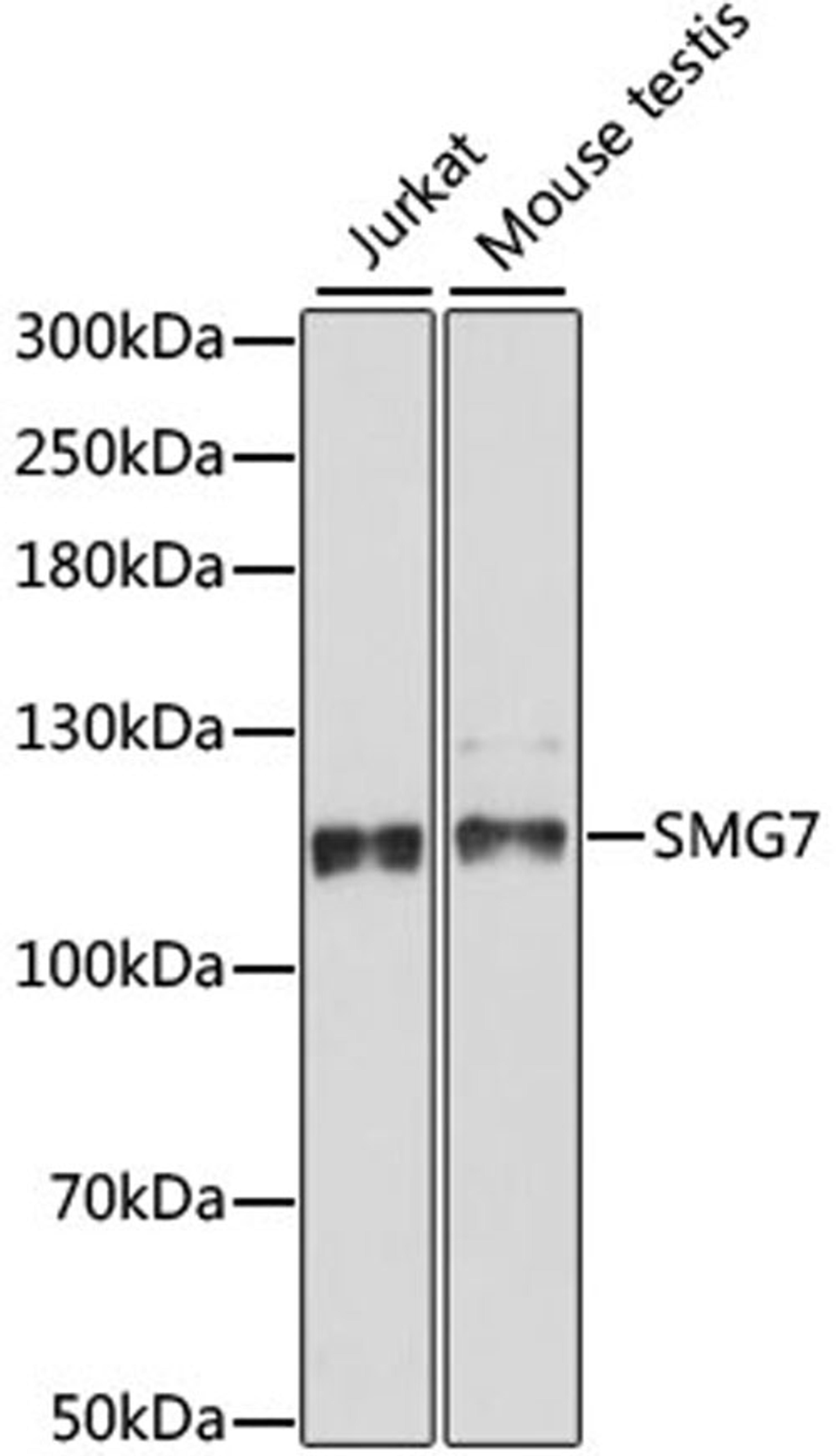 Western blot - SMG7 antibody (A15371)