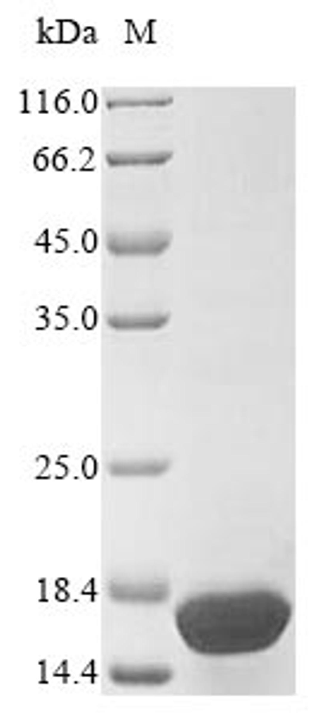 (Tris-Glycine gel) Discontinuous SDS-PAGE (reduced) with 5% enrichment gel and 15% separation gel.