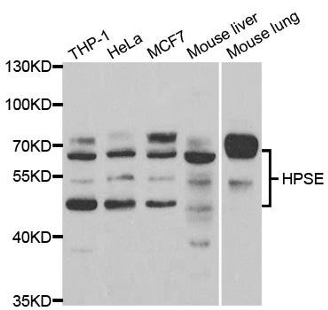 Western blot analysis of extracts of various cell lines using HPSE antibody