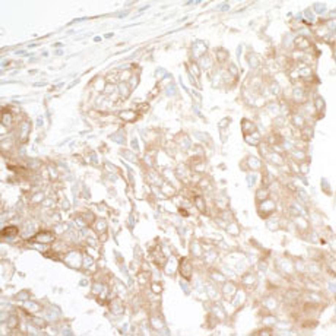 Detection of human GEF-H1 by immunohistochemistry.