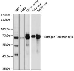 Western blot - Estrogen Receptor beta antibody (A2546)