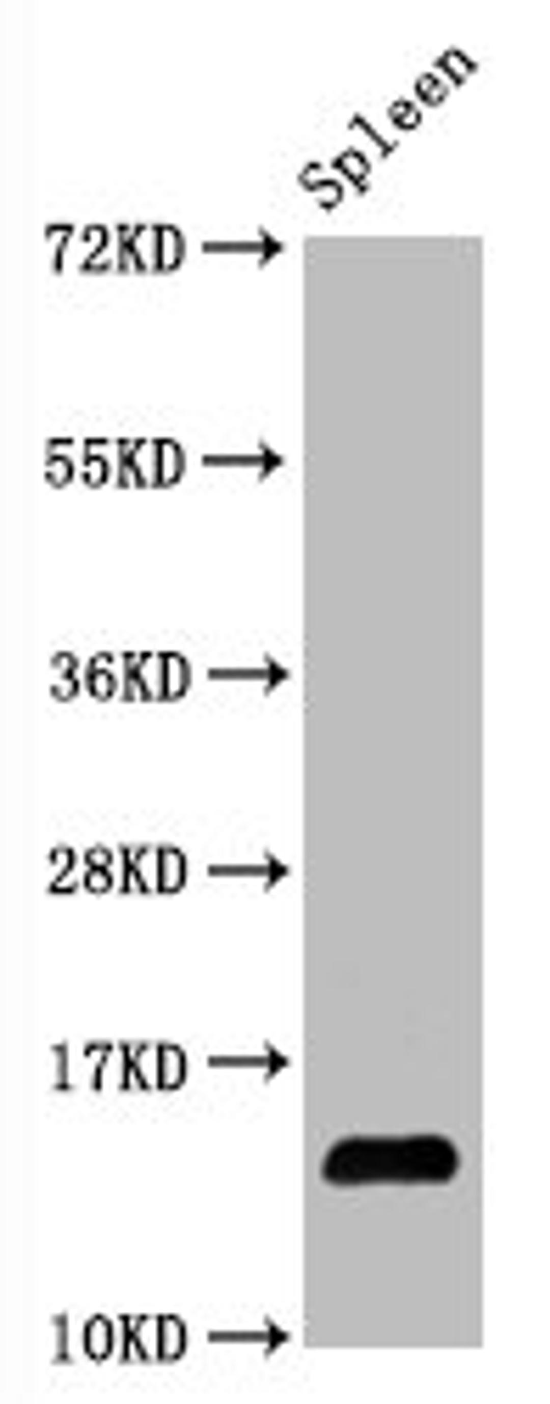 Western Blot. Positive WB detected in Mouse spleen tissueAll lanes Hydroxyl-Histone H2A type 1-B/E (Y39) antibody at 1.05μg/ml. Secondary. Goat polyclonal to rabbit IgG at 1/50000 dilution. Predicted band size: 14 KDa. Observed band size: 14 KDa.