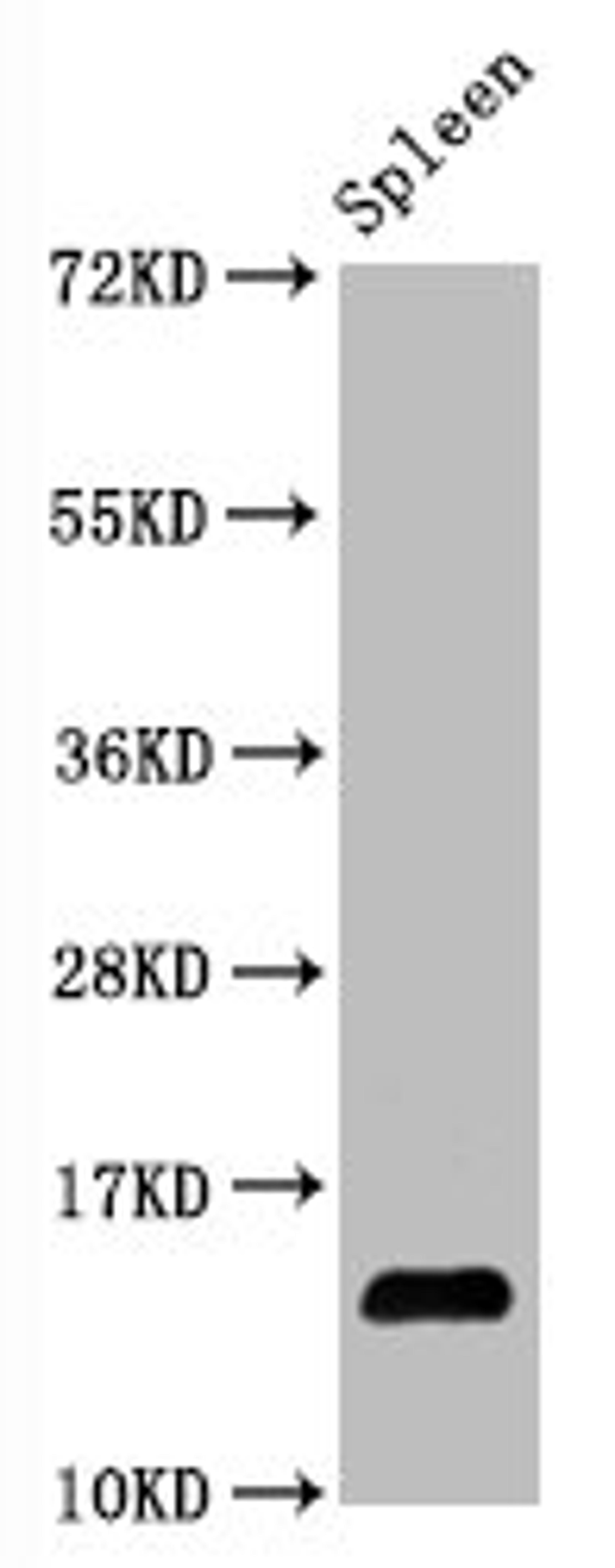 Western Blot. Positive WB detected in Mouse spleen tissueAll lanes Hydroxyl-Histone H2A type 1-B/E (Y39) antibody at 1.05μg/ml. Secondary. Goat polyclonal to rabbit IgG at 1/50000 dilution. Predicted band size: 14 KDa. Observed band size: 14 KDa.