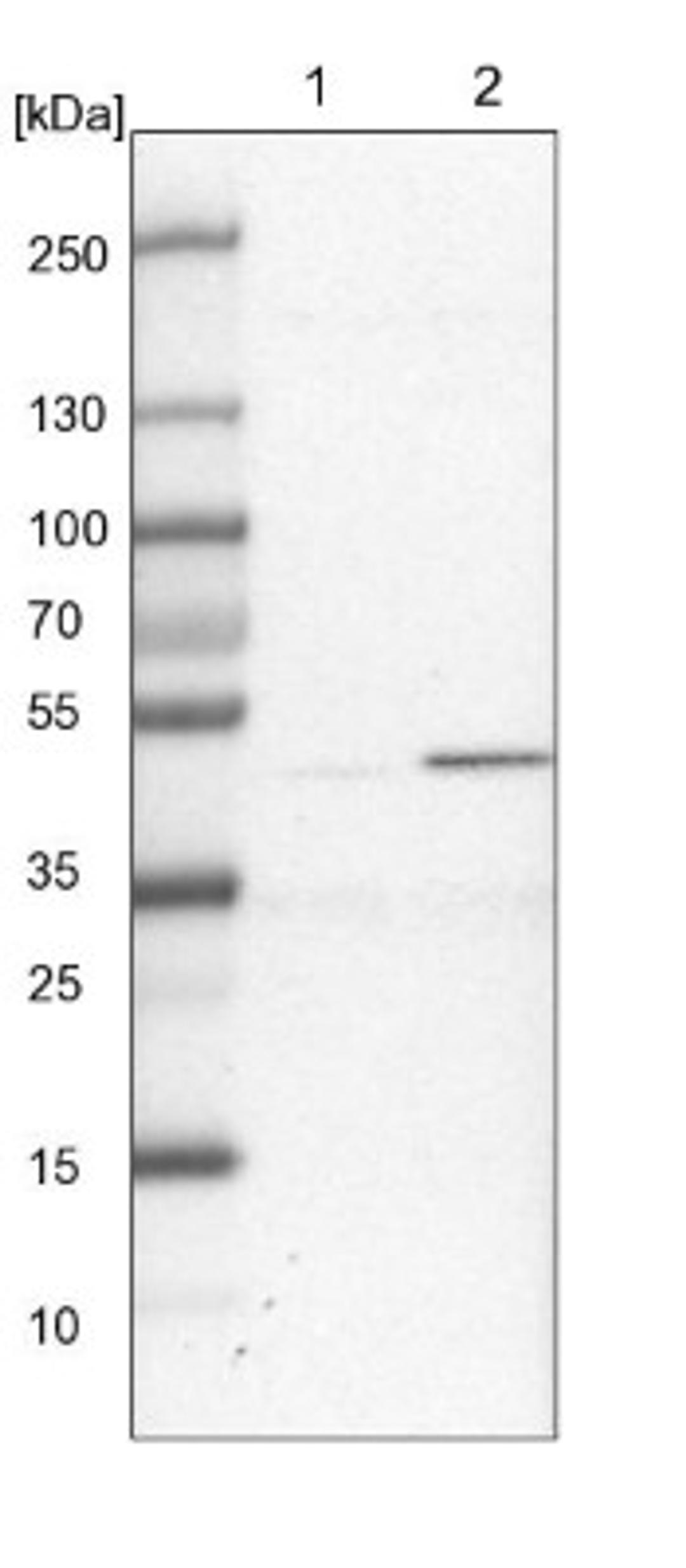 Western Blot: XAB1 Antibody [NBP1-90072] - Lane 1: NIH-3T3 cell lysate (Mouse embryonic fibroblast cells)<br/>Lane 2: NBT-II cell lysate (Rat Wistar bladder tumour cells)