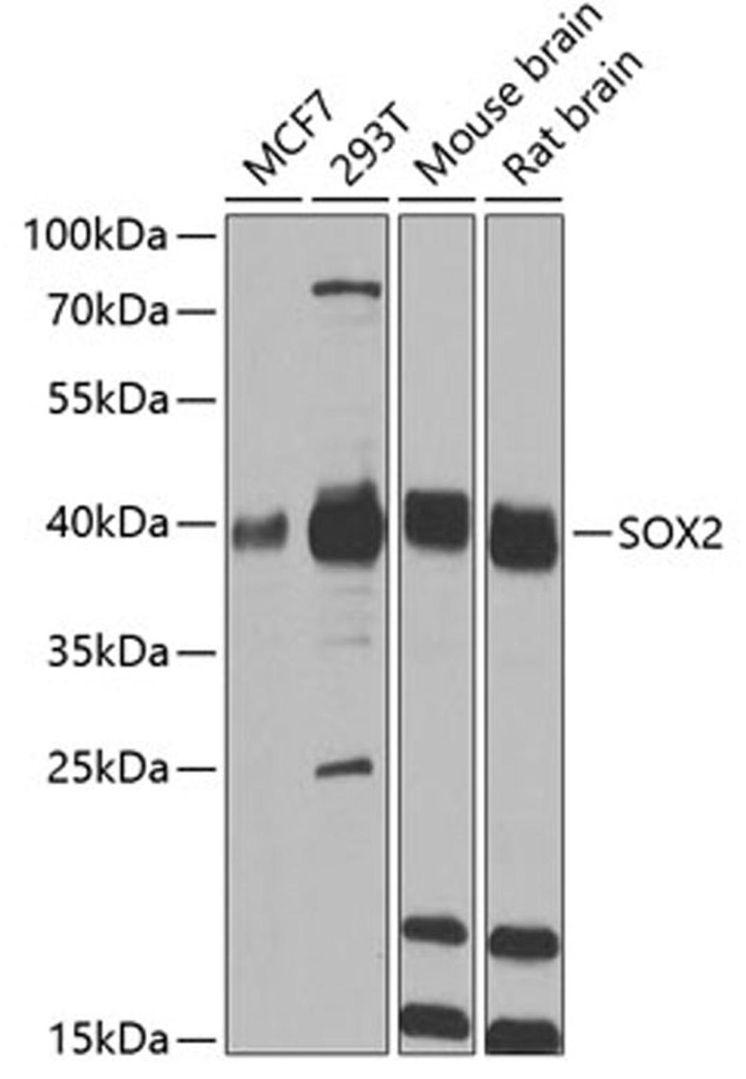 Western blot - SOX2 antibody (A0561)