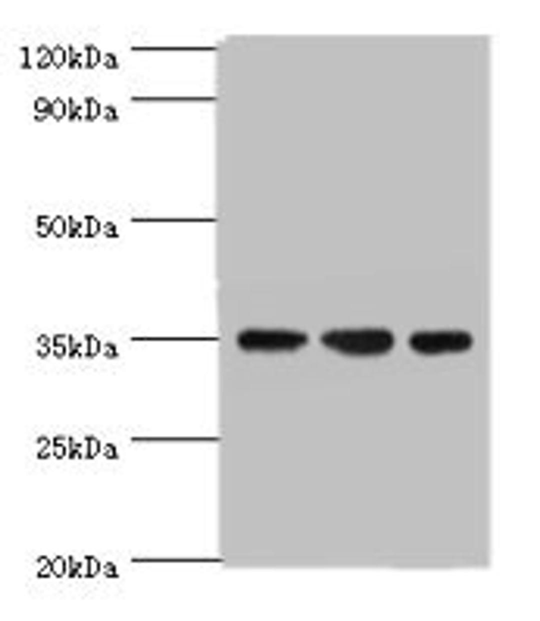Western blot. All lanes: AIMP2 antibody at 5ug/ml. Lane 1: Hela whole cell lysate. Lane 2: HepG2 whole cell lysate. Lane 3: K562 whole cell lysate. Secondary. Goat polyclonal to rabbit IgG at 1/10000 dilution. Predicted band size: 35 kDa. Observed band size: 35 kDa. 