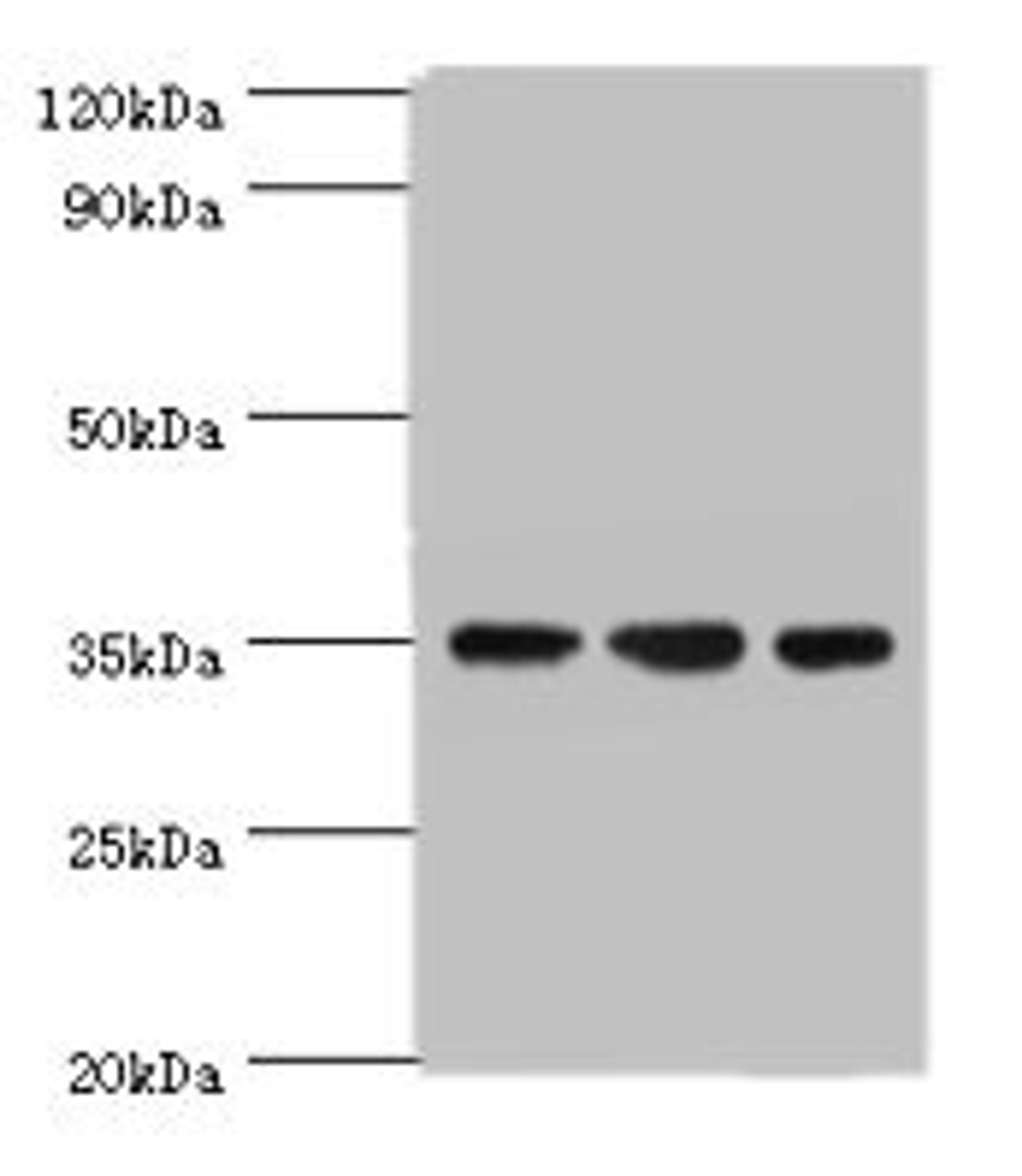 Western blot. All lanes: AIMP2 antibody at 5ug/ml. Lane 1: Hela whole cell lysate. Lane 2: HepG2 whole cell lysate. Lane 3: K562 whole cell lysate. Secondary. Goat polyclonal to rabbit IgG at 1/10000 dilution. Predicted band size: 35 kDa. Observed band size: 35 kDa. 