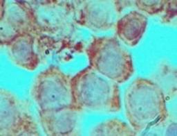 Immunohistochemistry-Paraffin: DLX3 Antibody [NBP2-24646] - Analysis of DLX3 in formalin-fixed, paraffin-embedded mouse testis tissue using this antibody at 5 ug/ml.