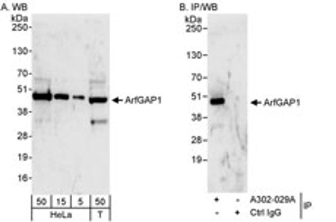 Detection of human ArfGAP1 by western blot and immunoprecipitation.