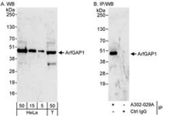 Detection of human ArfGAP1 by western blot and immunoprecipitation.