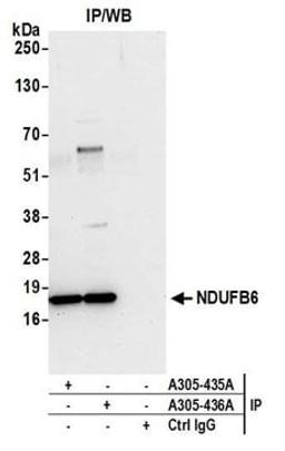 Detection of human NDUFB6 by western blot of immunoprecipitates.