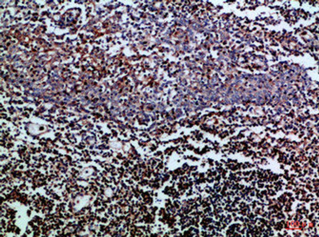 Immunohistochemical analysis of paraffin-embedded Human-tonsil, antibody was diluted at 1:100
