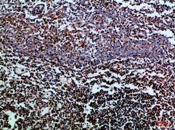 Immunohistochemical analysis of paraffin-embedded Human-tonsil, antibody was diluted at 1:100