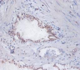 Immunohistochemistry of paraffin-embedded human prostate tissue using CSB-PA03124A0Rb at dilution of 1:100