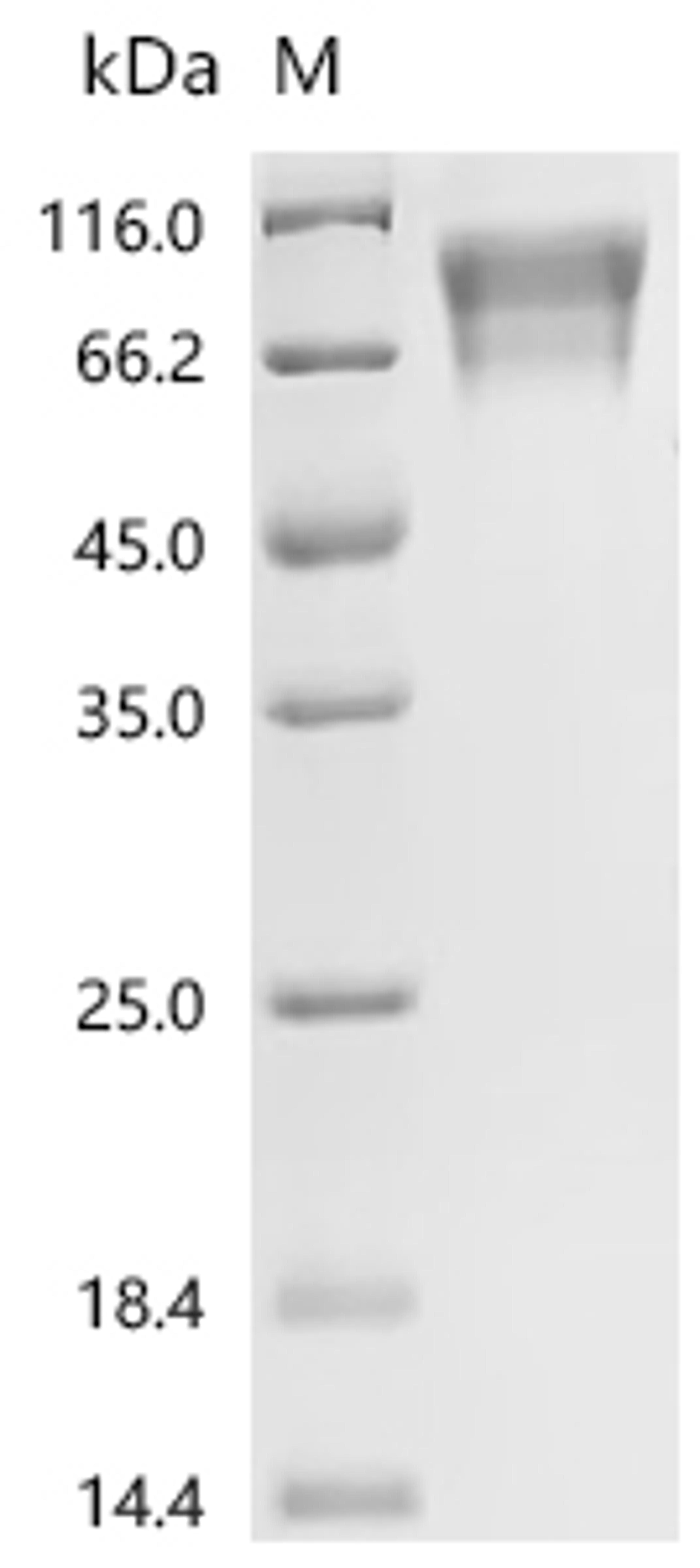 (Tris-Glycine gel) Discontinuous SDS-PAGE (reduced) with 5% enrichment gel and 15% separation gel.