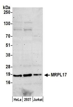 Detection of human MRPL17 by WB.