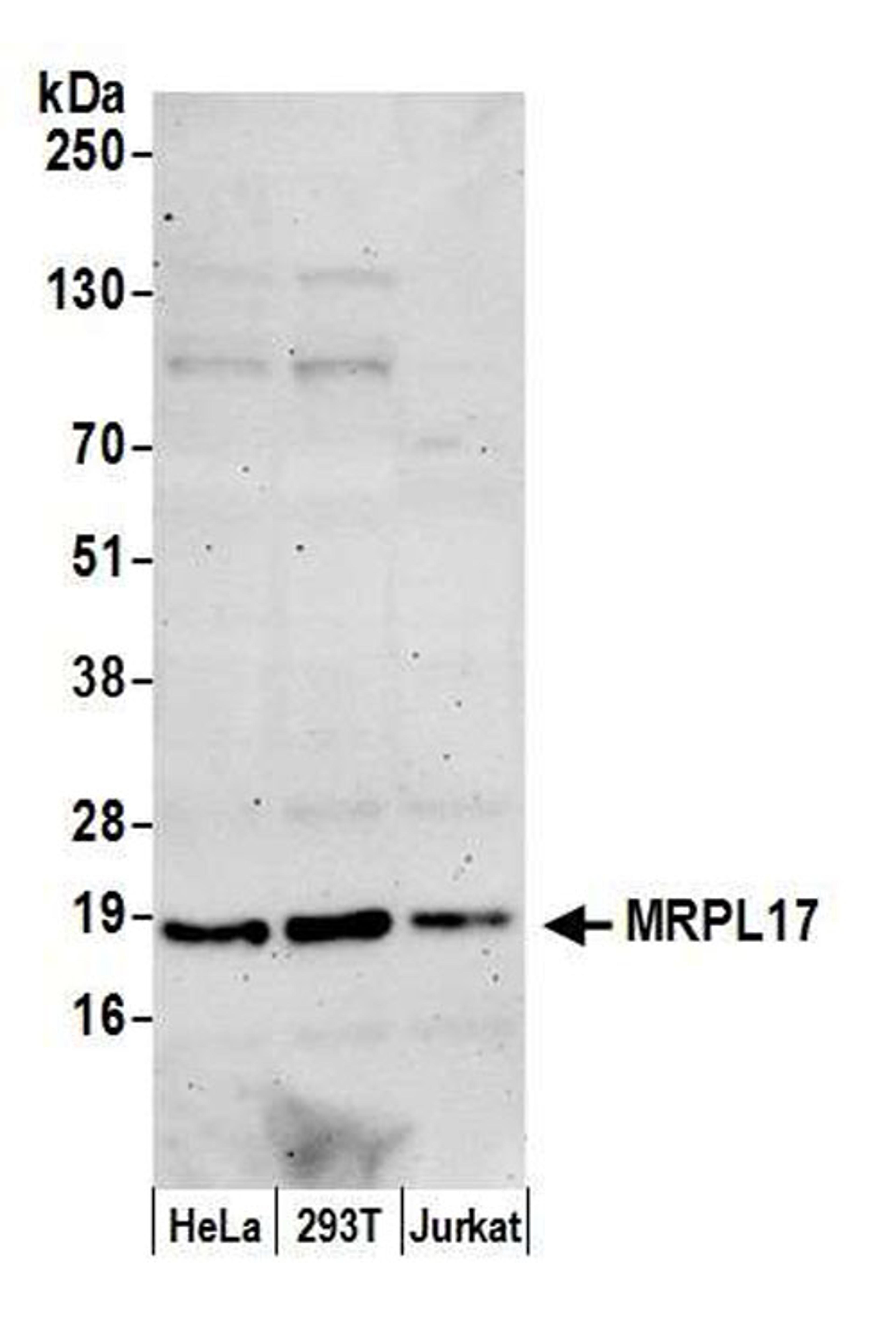 Detection of human MRPL17 by WB.