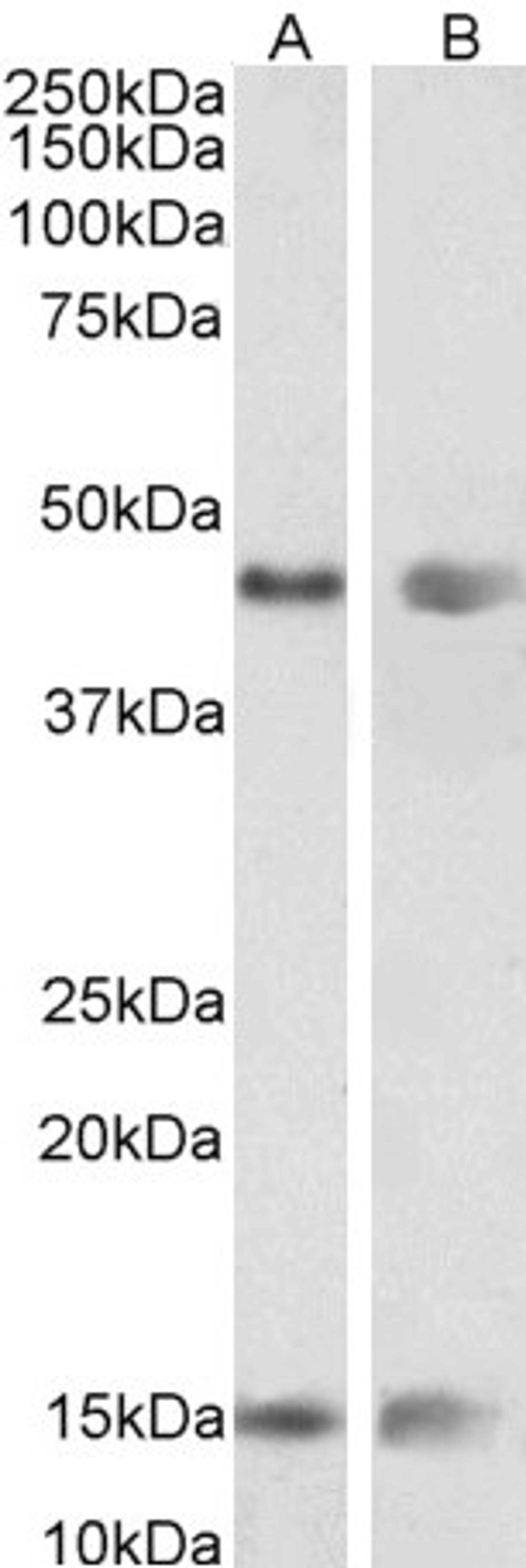 46-700 (0.01ug/ml) staining of Mouse (A) and Rat (B) Adrenal gland lysate (35ug protein in RIPA buffer). Detected by chemiluminescence.