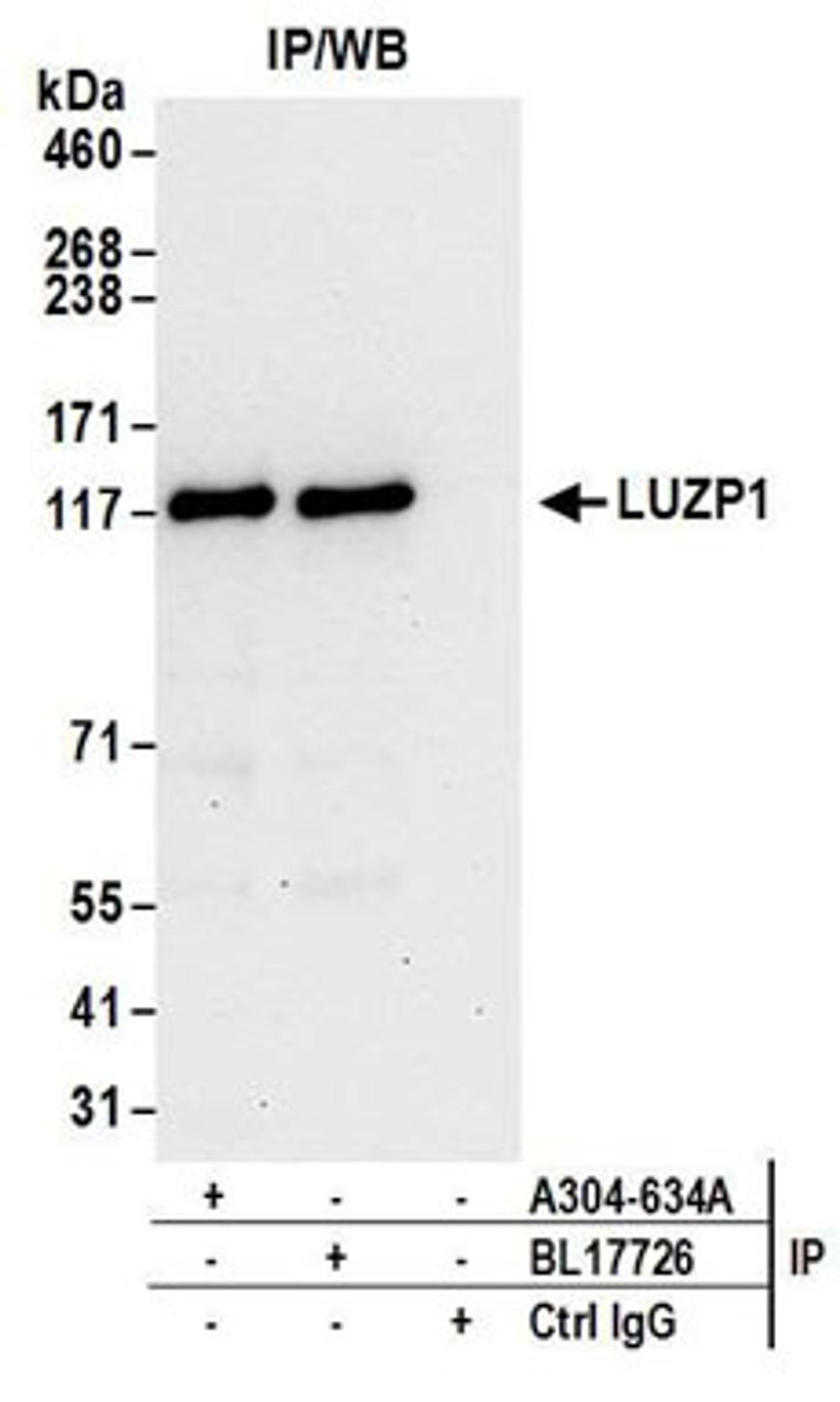 Detection of human LUZP1 by western blot of immunoprecipitates.