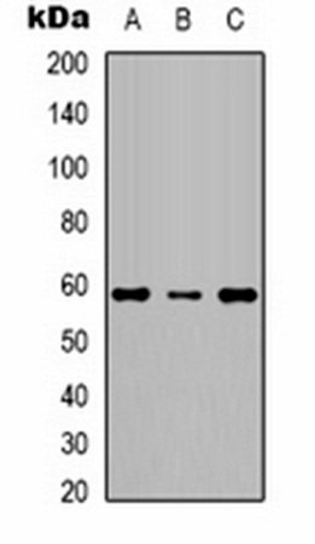 Western blot analysis of  Jurkat (Lane1), mouse brain (Lane2), rat brain (Lane3) whole cell lysates using KCNK10 antibody