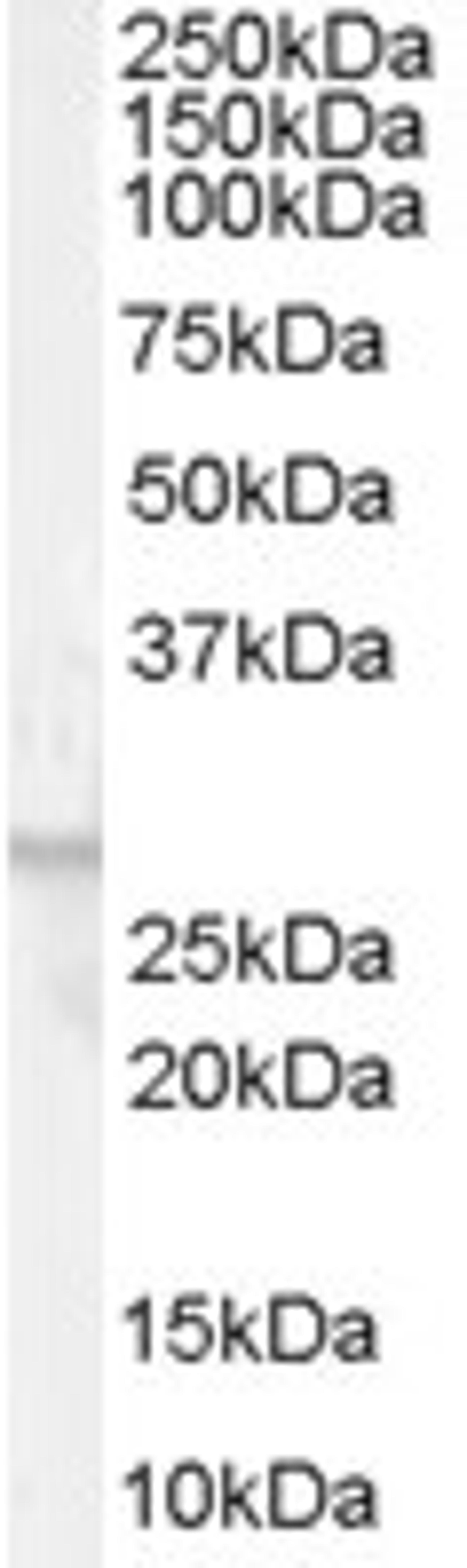 45-694 (0.01ug/ml) staining of Human Breast lysate (35ug protein in RIPA buffer). Primary incubation was 1 hour. Detected by chemiluminescence.