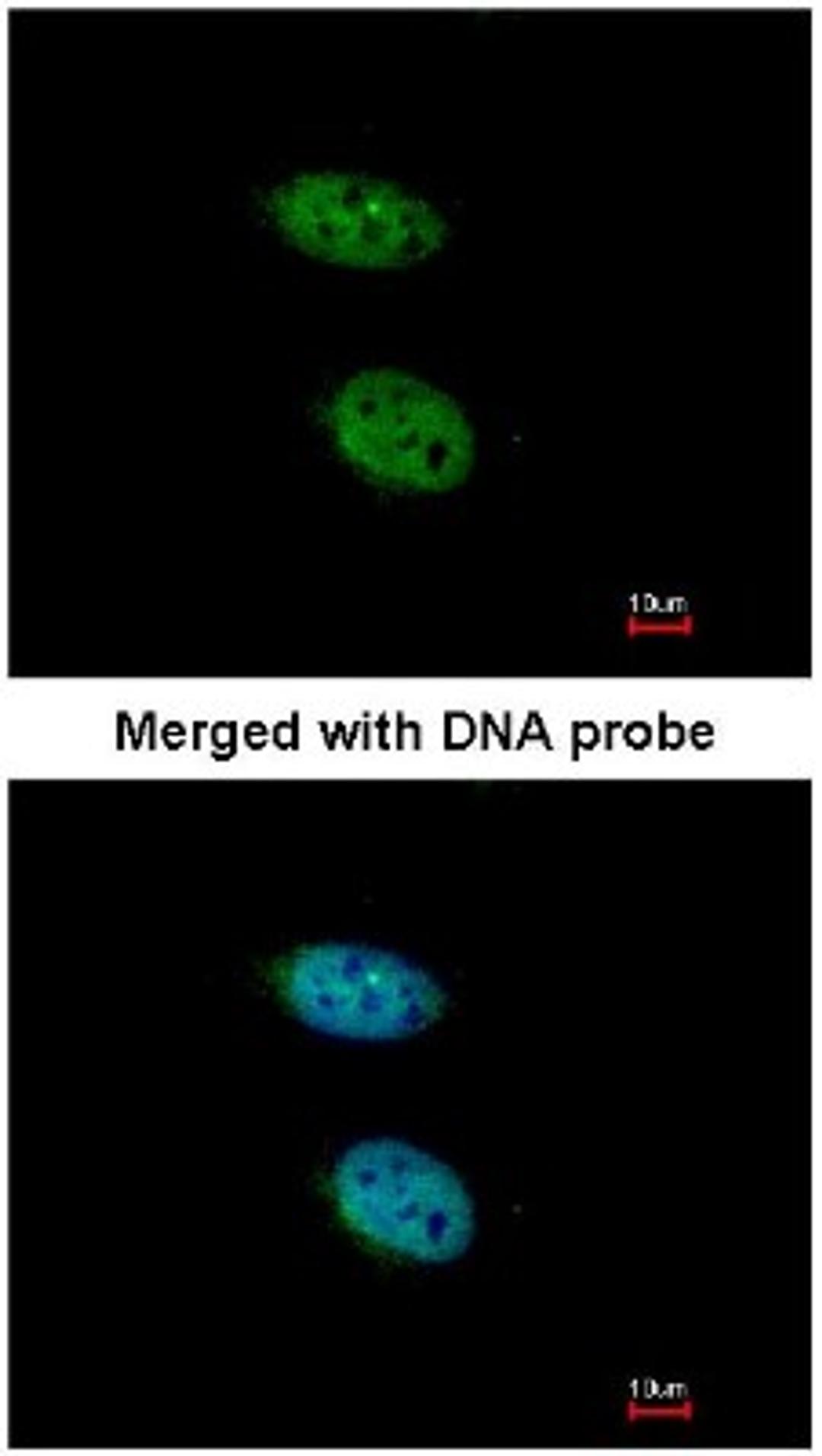 Immunocytochemistry/Immunofluorescence: PRPS2 Antibody [NBP1-31435] - Analysis of HaLa, using NBP1-31435 at 1:200 dilution.