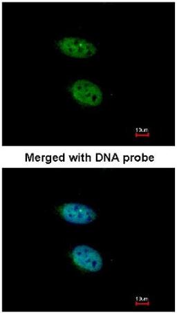 Immunocytochemistry/Immunofluorescence: PRPS2 Antibody [NBP1-31435] - Analysis of HaLa, using NBP1-31435 at 1:200 dilution.