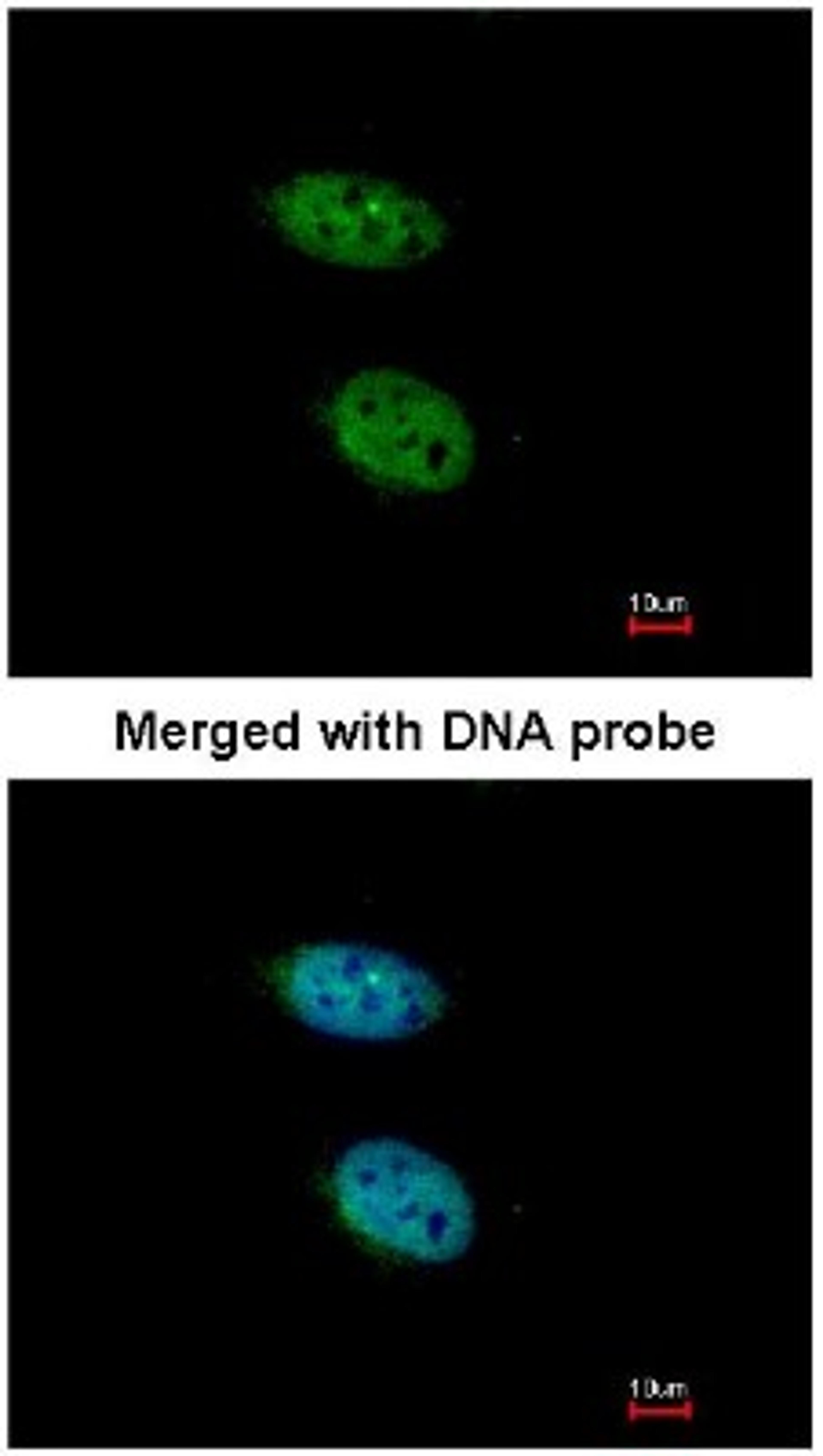 Immunocytochemistry/Immunofluorescence: PRPS2 Antibody [NBP1-31435] - Analysis of HaLa, using NBP1-31435 at 1:200 dilution.