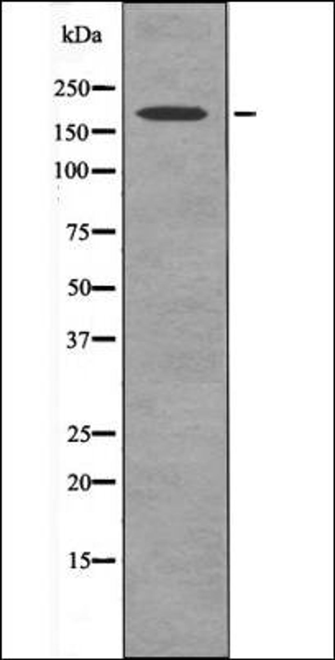 Western blot analysis of Calc LOVO whole cell lysates using PDGFRb -Phospho-Tyr579+Tyr581- antibody