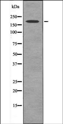 Western blot analysis of Calc LOVO whole cell lysates using PDGFRb -Phospho-Tyr579+Tyr581- antibody