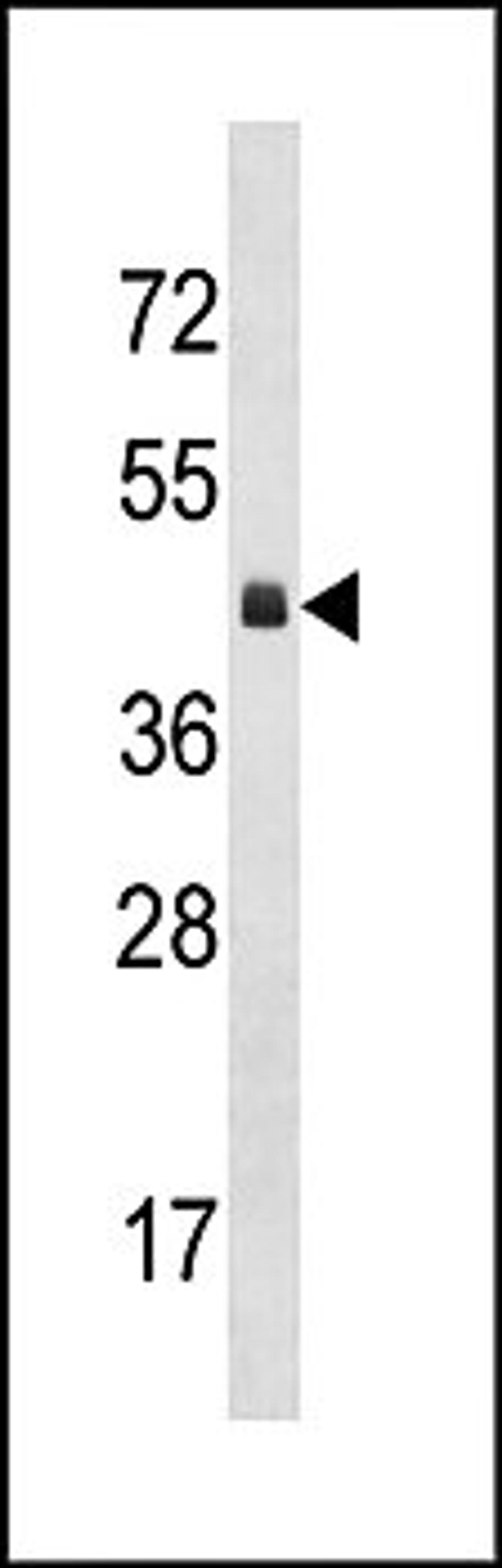 Western blot analysis of mouse heart tissue lysates (35ug/lane) using KLF12 (C-term) antibody