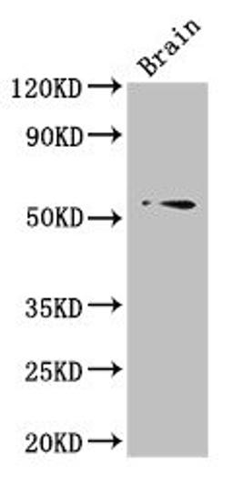 Western Blot. Positive WB detected in: Mouse brain tissue. All lanes: TRIM43 antibody at 3µg/ml. Secondary. Goat polyclonal to rabbit IgG at 1/50000 dilution. Predicted band size: 53 kDa. Observed band size: 53 kDa
