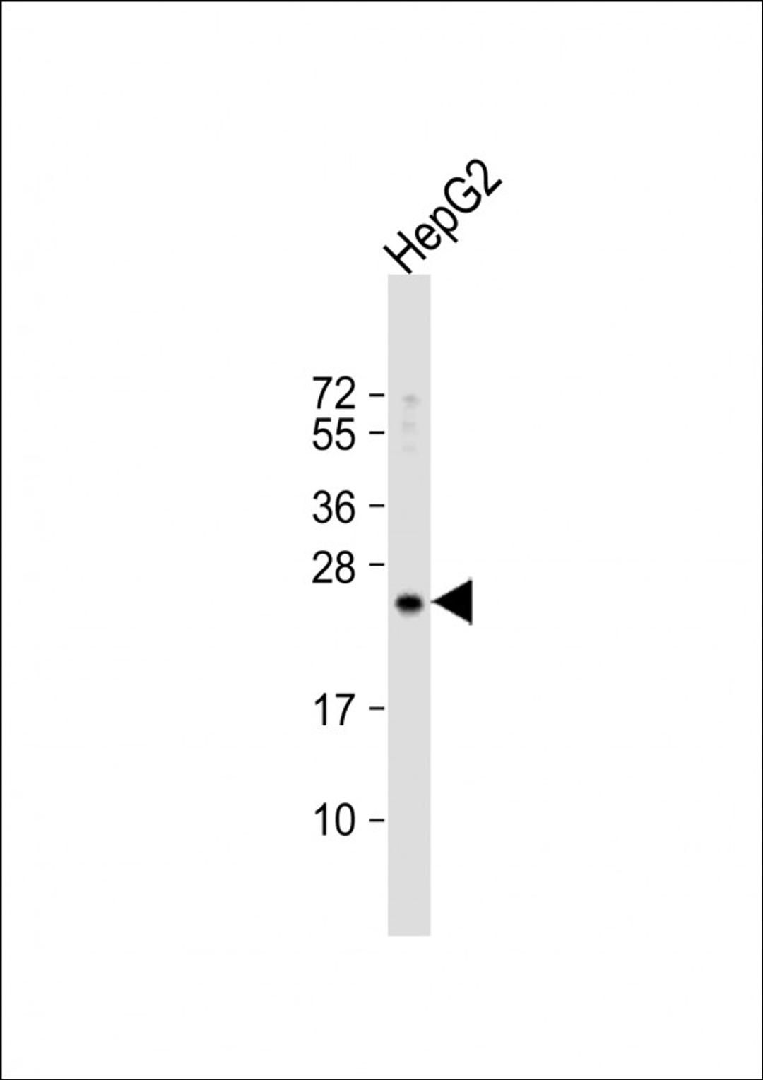 Western Blot at 1:1000 dilution + HepG2 whole cell lysate Lysates/proteins at 20 ug per lane.