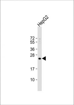 Western Blot at 1:1000 dilution + HepG2 whole cell lysate Lysates/proteins at 20 ug per lane.