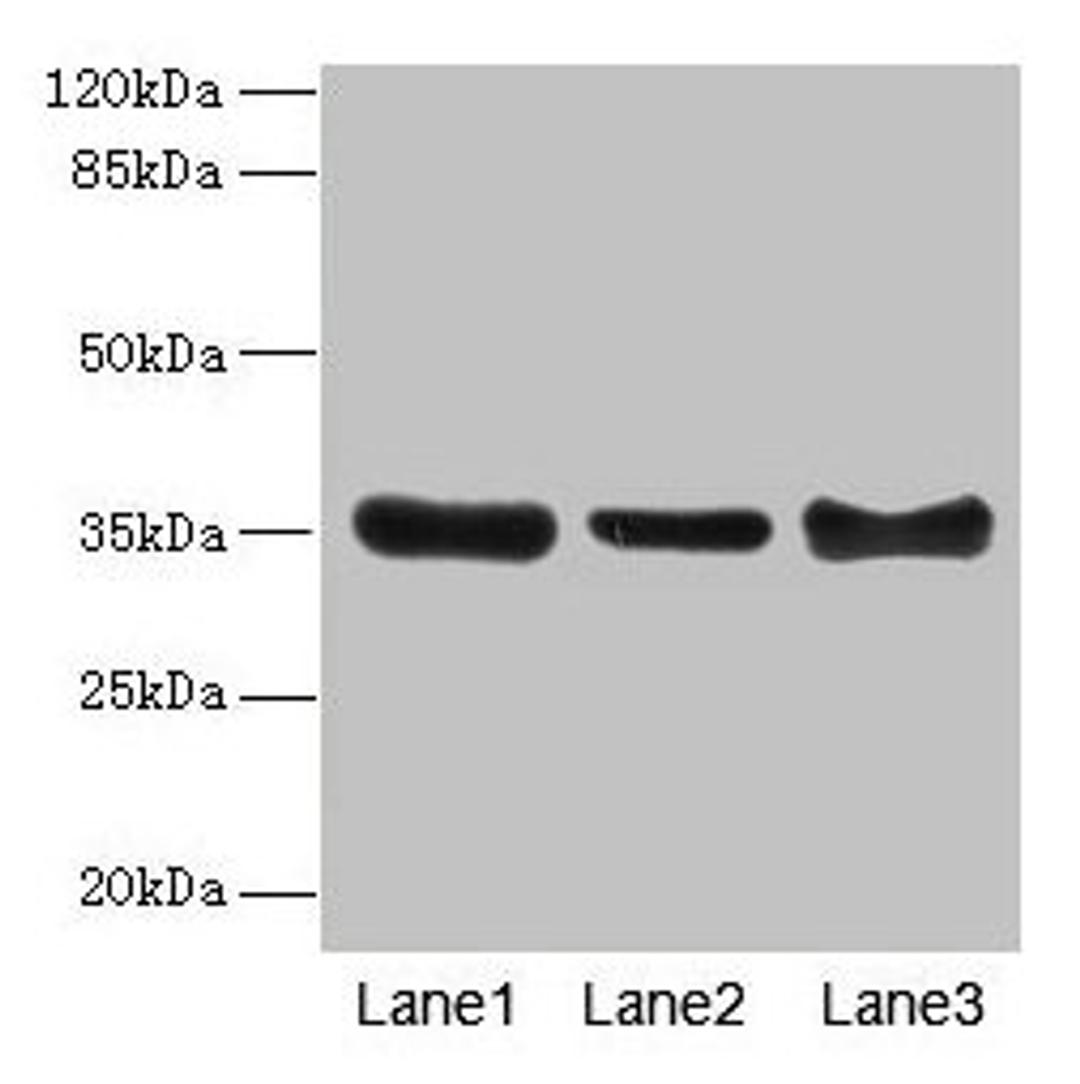 Western blot. All lanes: ZNF625 antibody at 4µg/ml. Lane 1: Mouse brain tissue. Lane 2: Mouse lung tissue. Lane 3: Mouse ovarian tissue. Secondary. Goat polyclonal to rabbit IgG at 1/10000 dilution. Predicted band size: 35, 43 kDa. Observed band size: 35 kDa