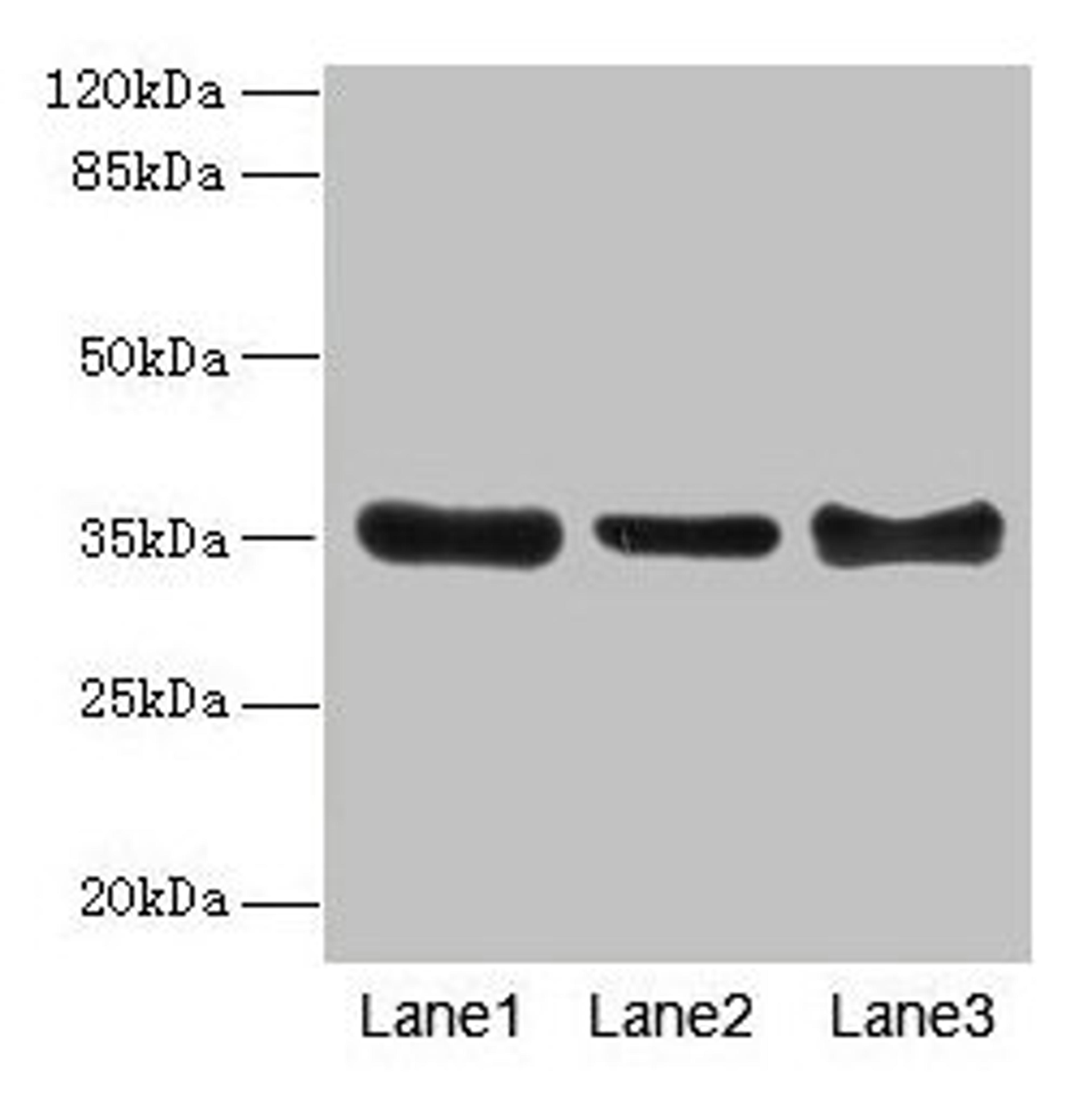 Western blot. All lanes: ZNF625 antibody at 4µg/ml. Lane 1: Mouse brain tissue. Lane 2: Mouse lung tissue. Lane 3: Mouse ovarian tissue. Secondary. Goat polyclonal to rabbit IgG at 1/10000 dilution. Predicted band size: 35, 43 kDa. Observed band size: 35 kDa