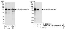 Western Blot: p190RhoGAP Antibody [NB100-88154] - Western Blot and Immunoprecipitation: p190RhoGAP  Antibody NB100-88154-Detection of Human p190RhoGAP  on HeLa whole cell lysate using NB100-88154. Gp190RhoGAP  was also immunoprecipitated by another rabbit ap190RhoGAP  antibody.