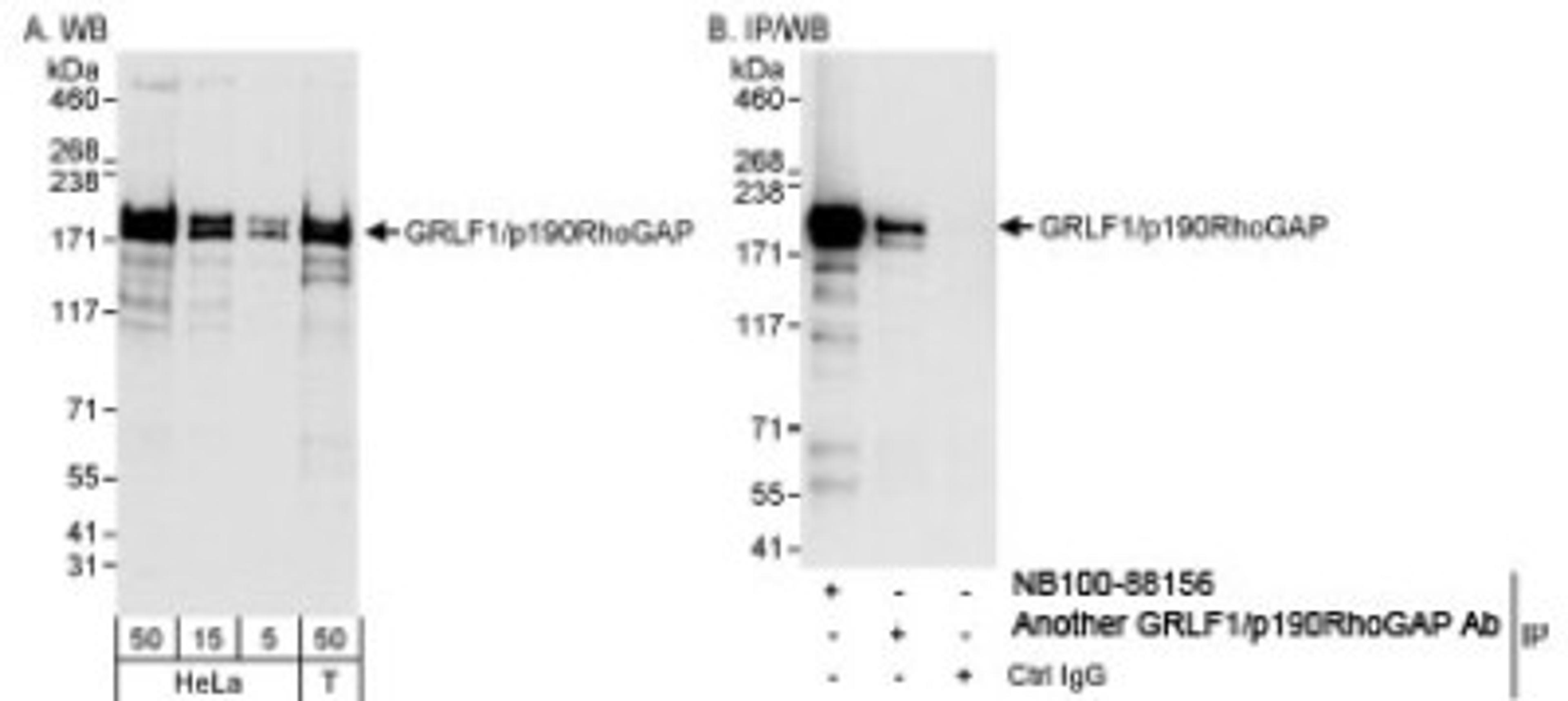 Western Blot: p190RhoGAP Antibody [NB100-88154] - Western Blot and Immunoprecipitation: p190RhoGAP  Antibody NB100-88154-Detection of Human p190RhoGAP  on HeLa whole cell lysate using NB100-88154. Gp190RhoGAP  was also immunoprecipitated by another rabbit ap190RhoGAP  antibody.